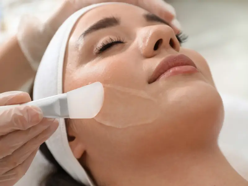 medycyna estetyczna brzozów-peeling chemiczny na zmiany trądzikowe